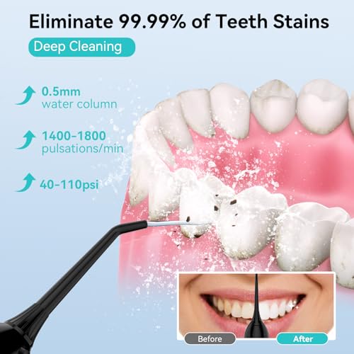15% Off Cordless Water Flosser with 4 Modes & 4 Tips - Image 3