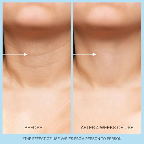 45% Off UJhay Retinol Neck Cream - Use Code DQMNJMSQ - Image 6