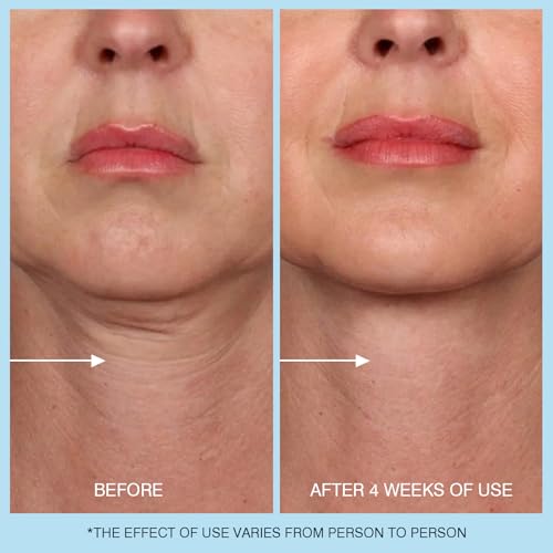 45% Off UJhay Retinol Neck Cream - Use Code DQMNJMSQ - Image 7