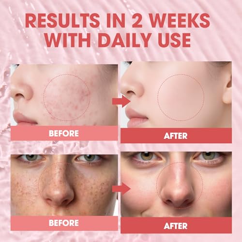 58% Off Pink PDRN Peptide Serum – Salmon DNA & Peptides - Image 4