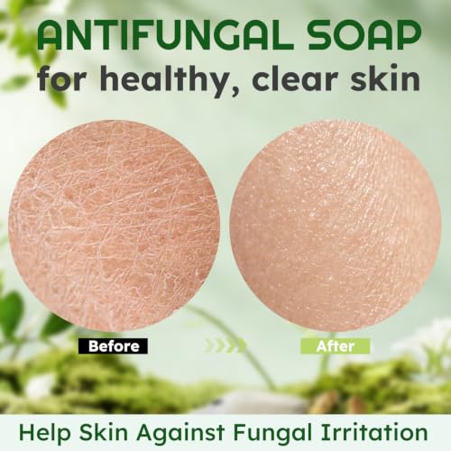 Buy 1 Get 1 Free? Save on Antifungal Tea Tree Soap Bars - Image 8