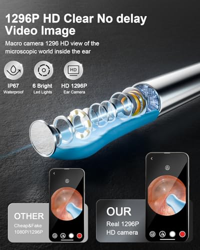 65% Off NEATEST Ear Wax Removal Tool with Camera - Image 4