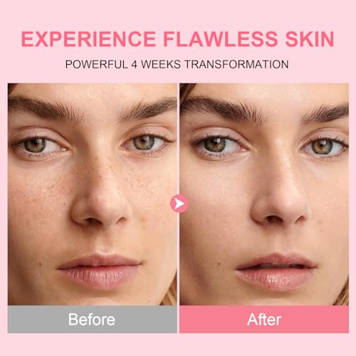 50% Off AVJONE Niacinamide & TXA Serum for Glass Skin - Image 6