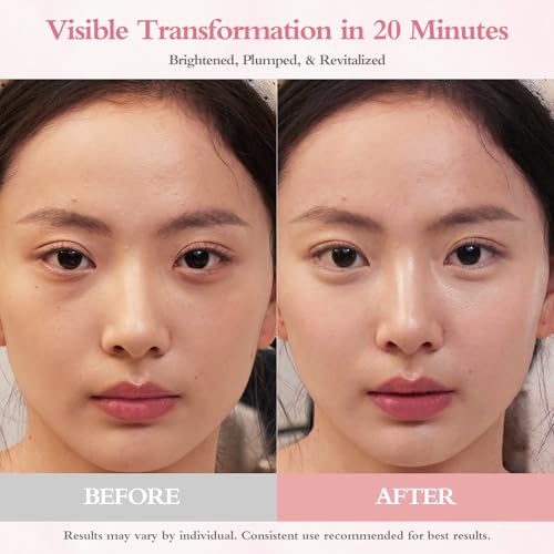 64% Off PDRN Eye Patches with Code RF8YDR2J - Image 3