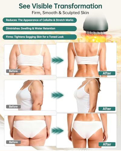 58% Off Yerepk Lymphatic Drainage Massager with Code MBW6RBUG - Image 3