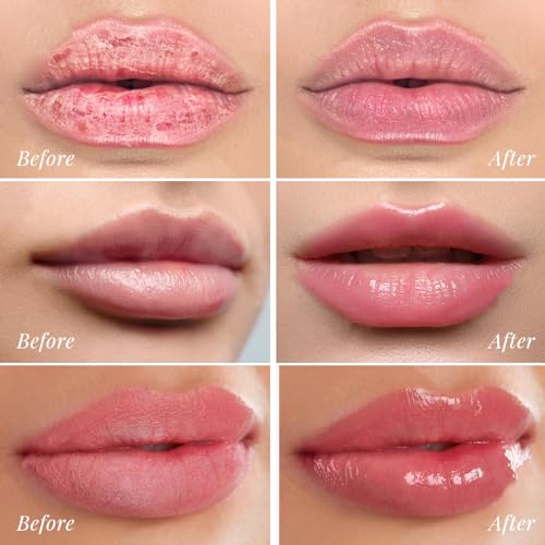 50% Off ANRCOLLECT Overnight Lip Mask Set with Code QRQ9W694 - Image 6