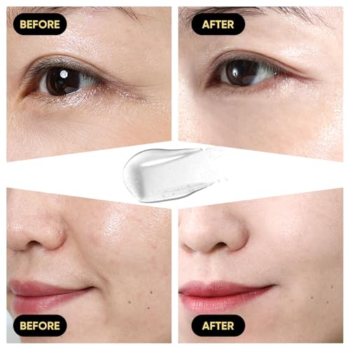 50% Off Snail Mucin Serum for Hydration & Skin Repair - Image 5