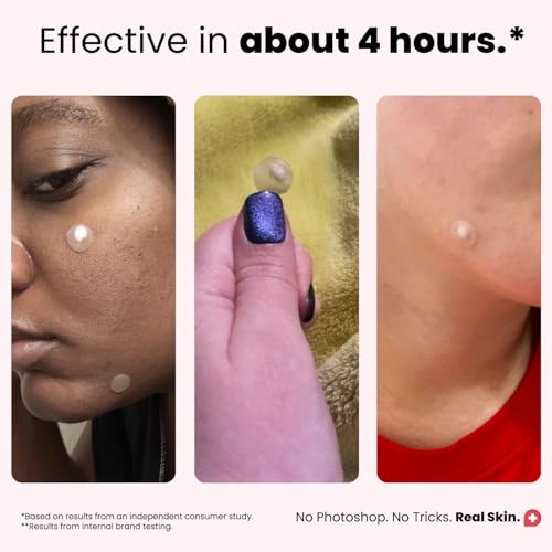 50% Off Roselynboutique Pimple Patches with Code 3EOTHOAA - Image 6