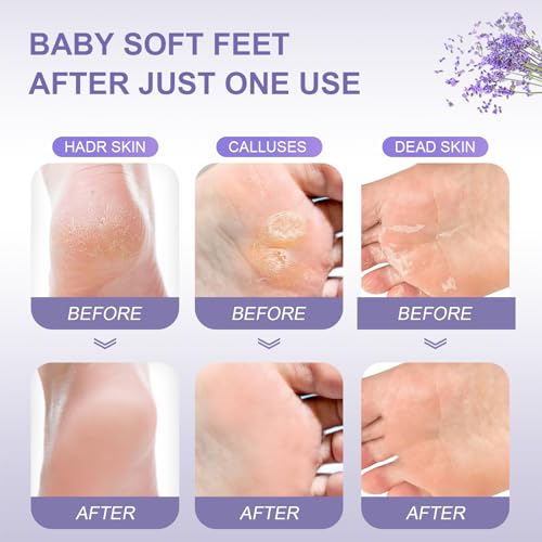 40% Off FUNNIR Foot Peeling Mask Pack for Smooth Feet - Image 4