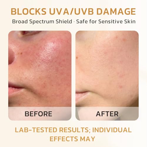 50% Off Gentle SPF 40 Face Sunscreen with Code 3CWT9KBD - Image 2