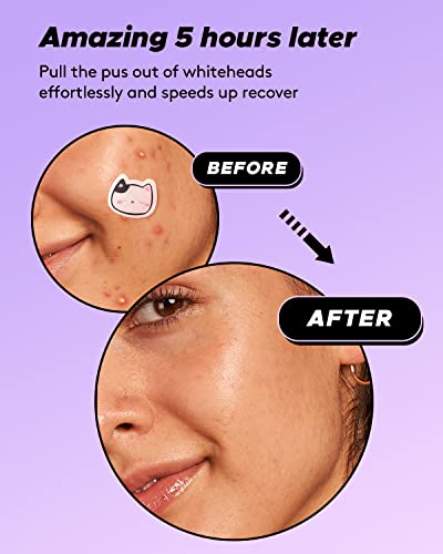 50% Off LitBear Cat-Shaped Acne Patches with Code XEQ3YSIB - Image 6