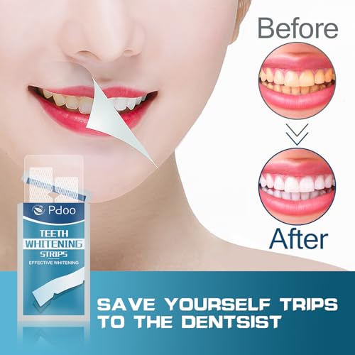 65% Off Pdoo Teeth Whitening Strips for Sensitive Teeth - Image 4