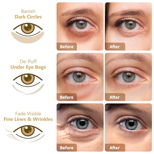 Save $4 on 30-Pair Under Eye Patches with 24K Gold - Image 3