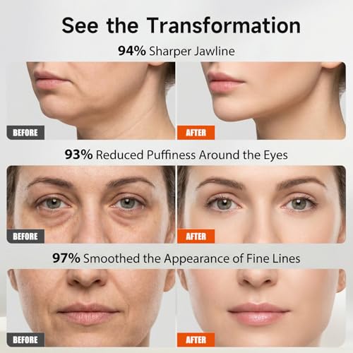 33% Off SUNLUXY Electric Heated Gua Sha Face Massager - Image 2