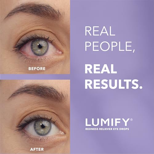 LUMIFY Redness Relief Eye Drops for Brighter Eyes - Image 2
