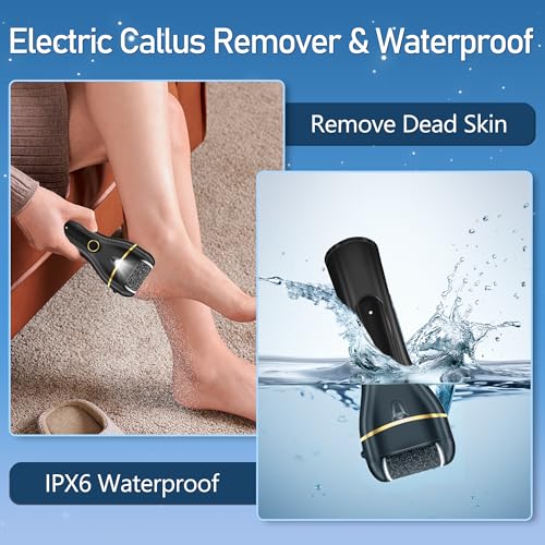 Save 35% on Jamestry Electric Foot Callus Remover Kit - Image 2