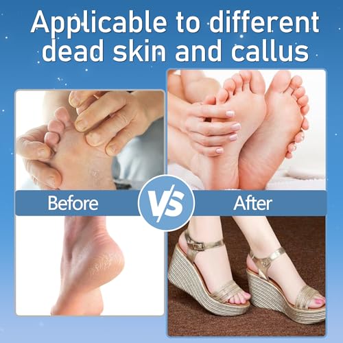 Save 35% on Jamestry Electric Foot Callus Remover Kit - Image 4