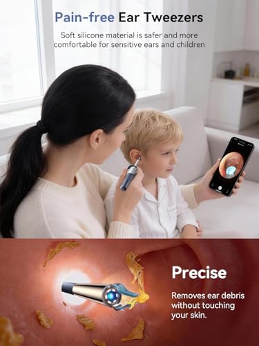 50% Off ZERONDER Ear Wax Removal Camera Tool - Image 3