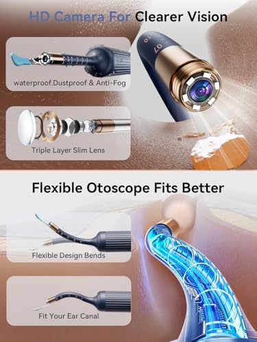 50% Off ZERONDER Ear Wax Removal Camera Tool - Image 4