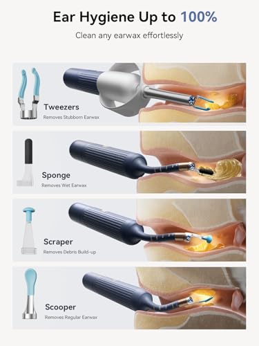50% Off ZERONDER Ear Wax Removal Camera Tool - Image 5