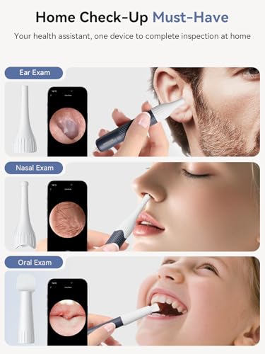 50% Off ZERONDER Ear Wax Removal Camera Otoscope - Image 7