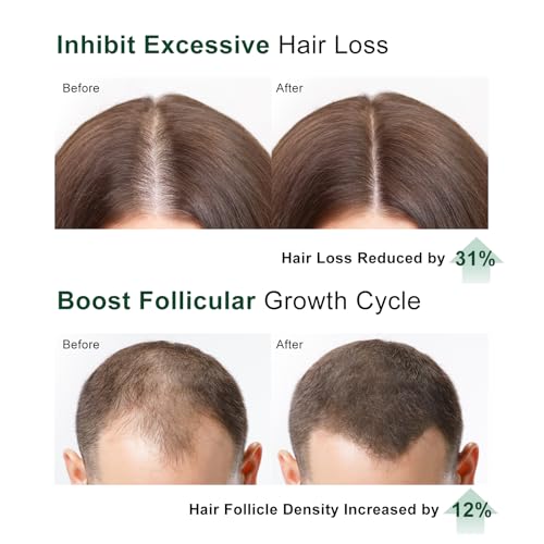 55% Off GOOSURE Hair Growth Serum with Code E83I8YI5 - Image 3