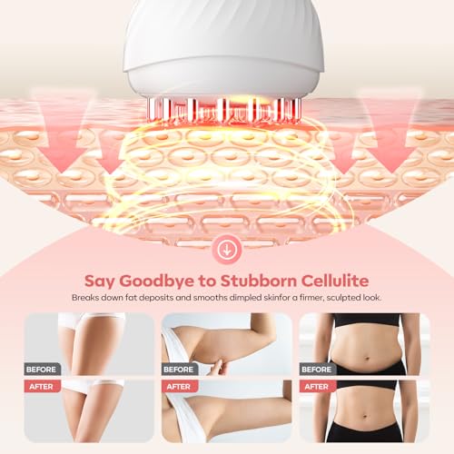 50% Off Lymphatic Drainage Massager with Heat & Vibration - Image 3