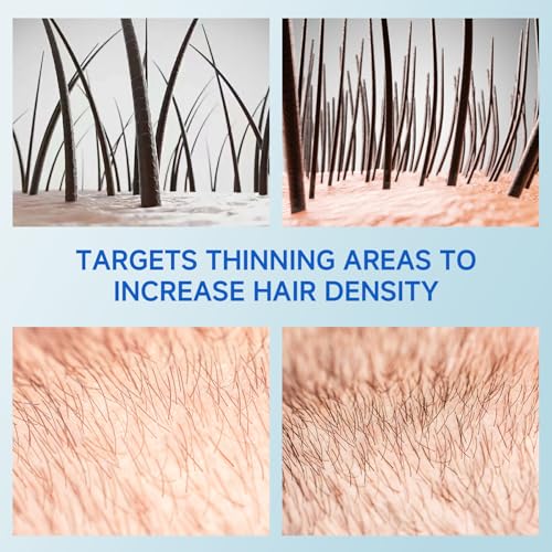 50% Off Hair Growth Serum with Rosemary Oil Roll-On - Image 4