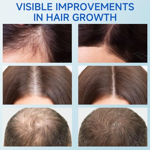 50% Off Hair Growth Serum with Rosemary Oil Roll-On - Image 5