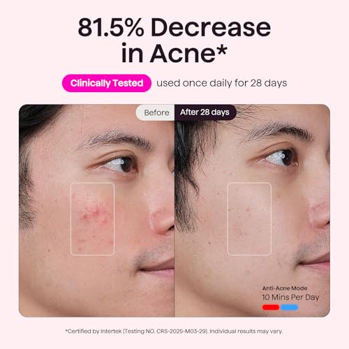 55% Off Wavytalk LED Face Mask with Code WJ56GV3Z - Image 4