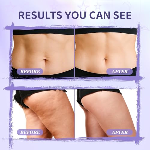 50% Off Overnight Firming Cellulite Cream with Code UV3S45VC - Image 4