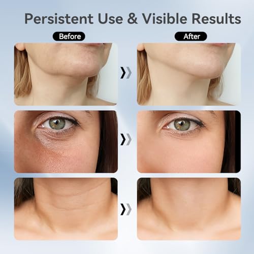 75% Off YUNRUO Neck Face Massager, Only $9.99 - Image 4