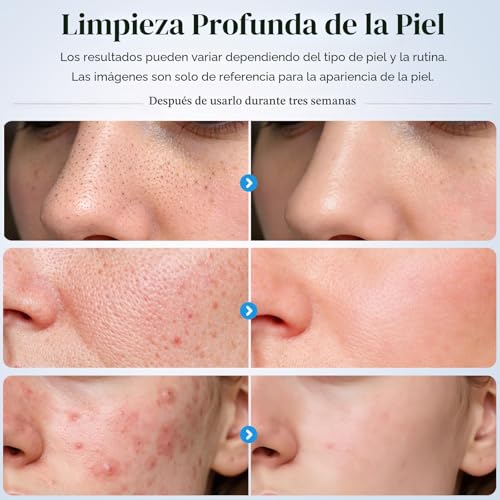 Save 29% on GUGUG Skin Scrubber Facial Cleanser - Image 5