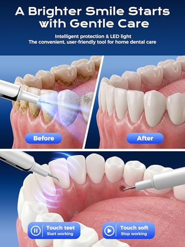 46% Off Electric Plaque Remover for Teeth - Image 2