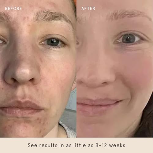 33% Off Barefaced Glow Peel Pads (60 Count) - Deep Exfoliating - Image 7