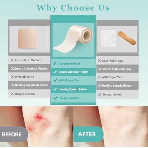 50% Off Medical Hydrocolloid Roll for Wound Care - Image 2