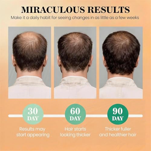 25% Off 100% Organic Batana Hair Oil – Code O7M6YGA9 - Image 5