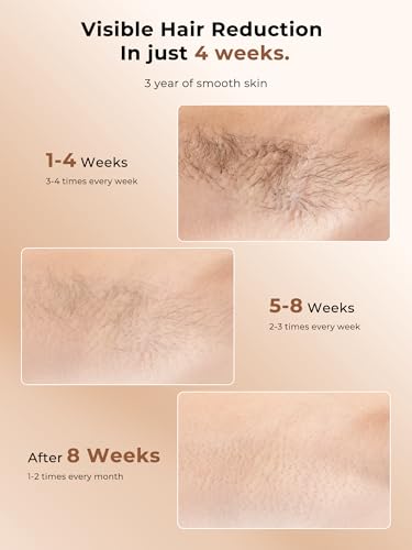 36% Off Ubroo IPL Hair Removal with Ice Cooling - Image 5