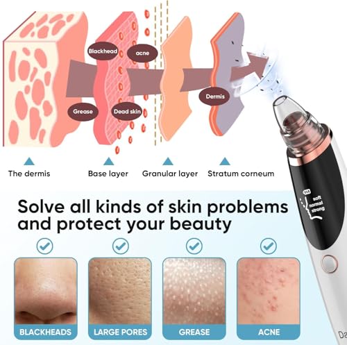 53% Off Daweir Blackhead Remover Pore Vacuum - Use Code 7D4NS5CV - Image 4