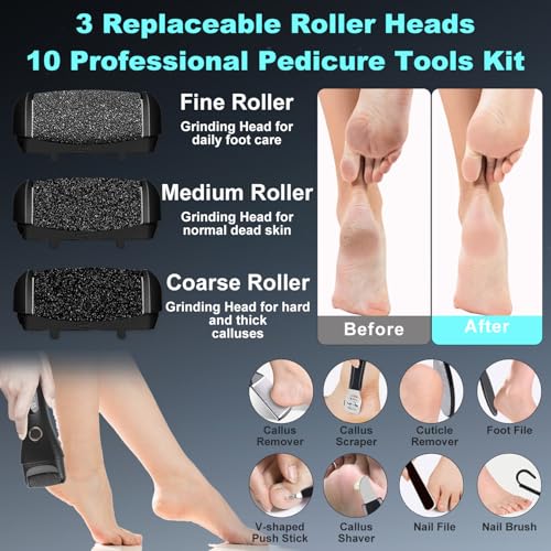 50% Off Electric Callus Remover with Pedicure Kit - Image 5